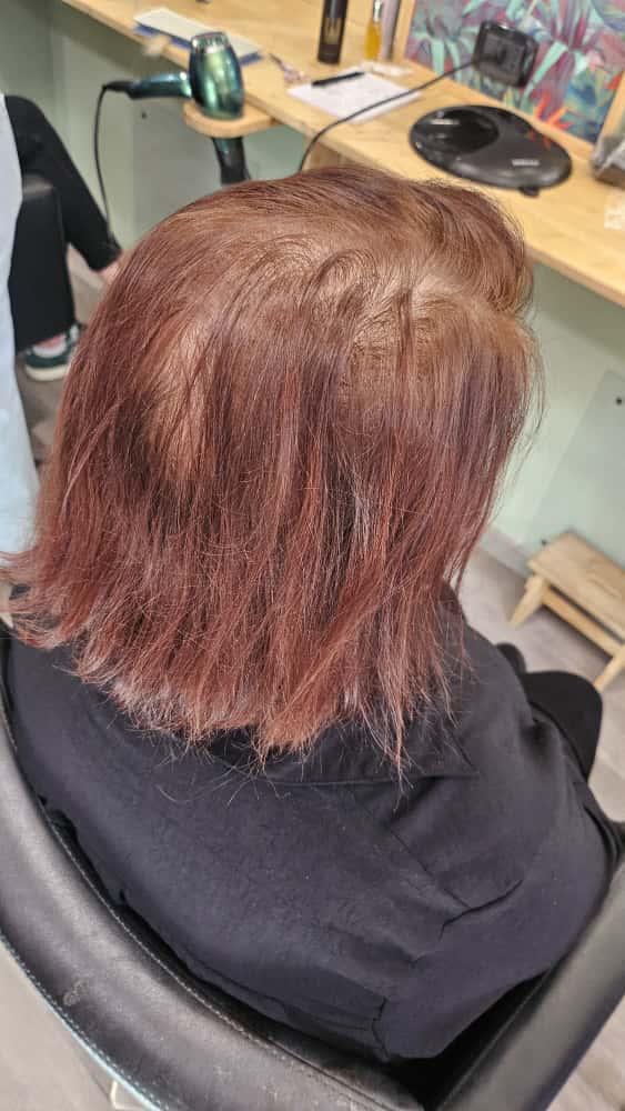 Infoltimento capelli